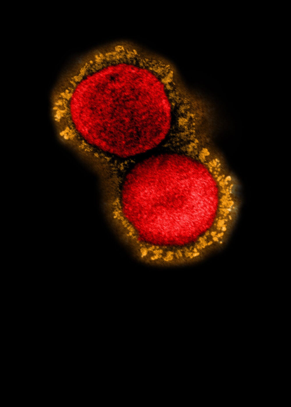 How SARS-CoV-2 evades immune system defenses — Harvard Gazette
